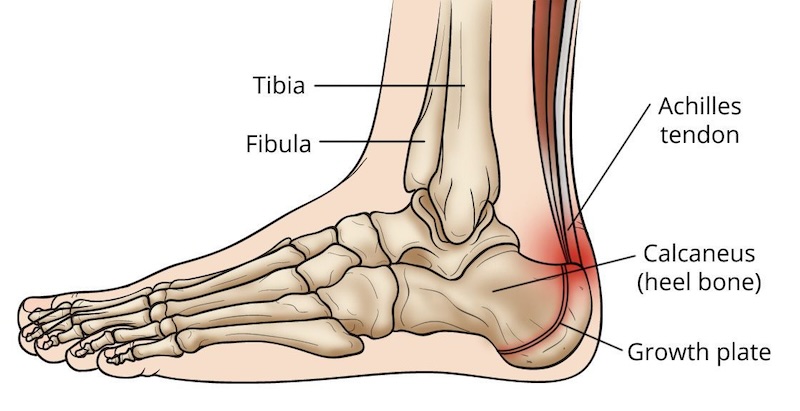 customer's problems heel